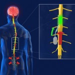 Smart Chip That Can Block Pain Signals Traveling To the Brain