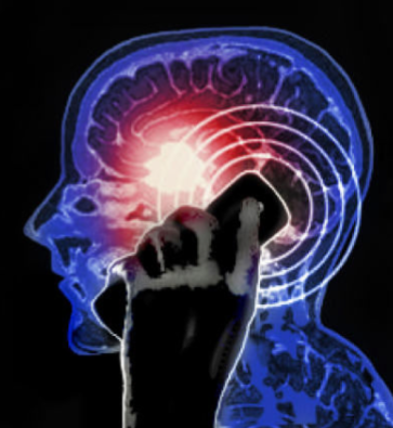 cell-phone-brain-tumor cellphone radiation debate